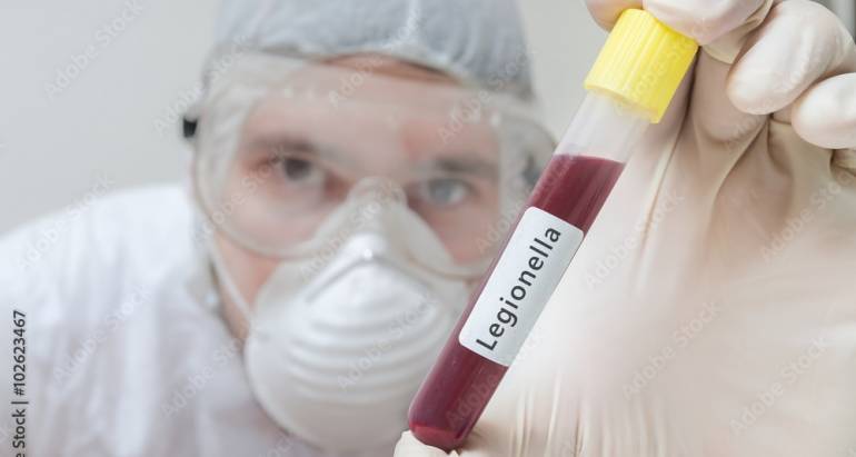 PREVENZIONE LEGIONELLA
